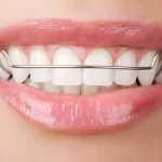 Top 7 Tips To Properly Care For Your Retainers
