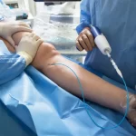 Common Conditions Treated by Vascular Surgeons